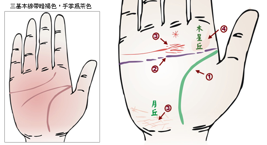 掌紋分析：腦溢血掌徵