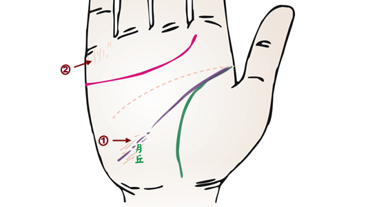 掌紋分析：膀胱炎掌徵