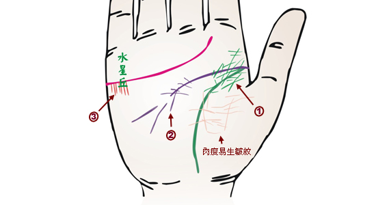 掌紋分析：哮喘掌徵